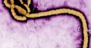 gambar-virus-ebola